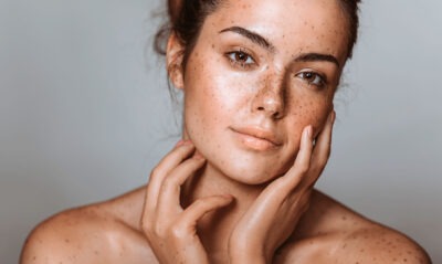 DARK SPOTS